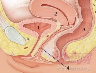 Ů�ñ���������չʾ09