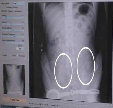 �ϲ������ƻ�һ�ش����ڲض��� �����װ�����Ʒ