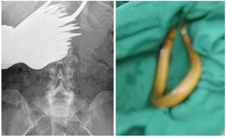 ����ƨ�������